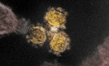 virus-corona-covid-19.jpg